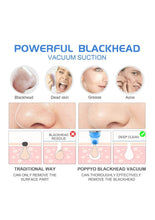 Load image into Gallery viewer, Blackhead Remover (Pink)